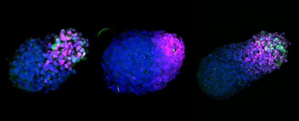 Startling human embryo model from stem cells reveals unseen stages of our development