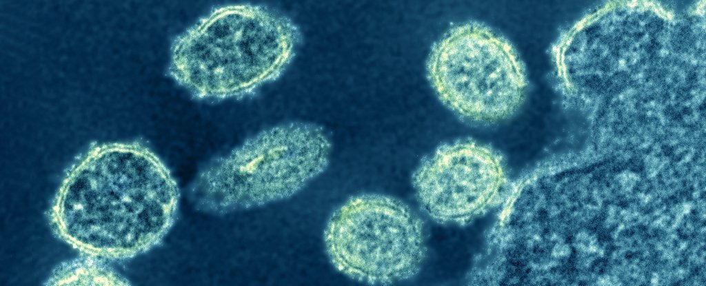 Electron micrograph of G4 relative, H1N1 