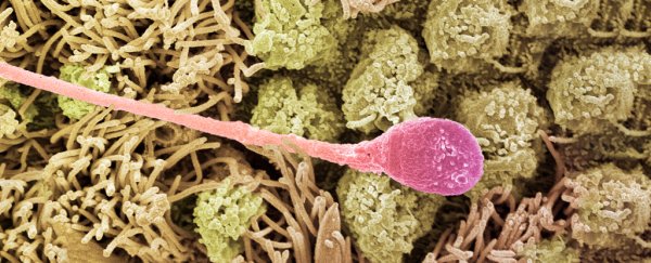 Scanning electron micrograph of a sperm cell