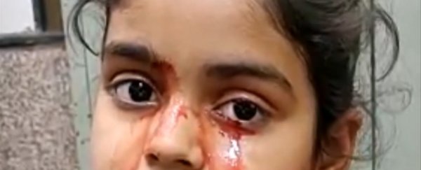 11-year-old girl cries blood in incredibly rare medical case, confusing doctors