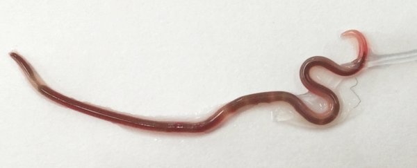 Wriggling Roundworm Found in Woman's Tonsil After She Ate Sashimi