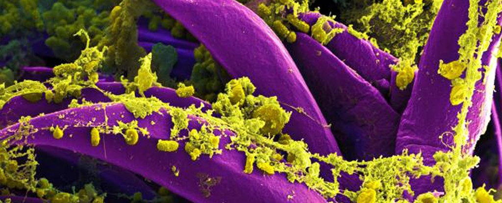 Yersinia pestis bacteria that causes bubonic plague 