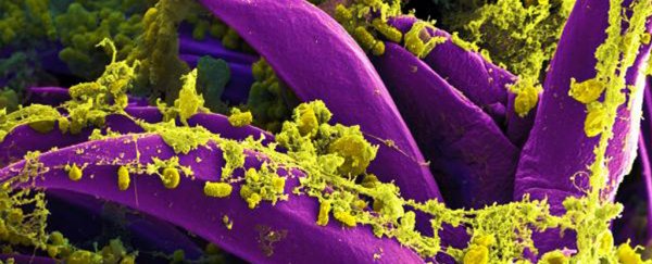 Warnings issued as China confirms a case of bubonic plague in Inner Mongolia