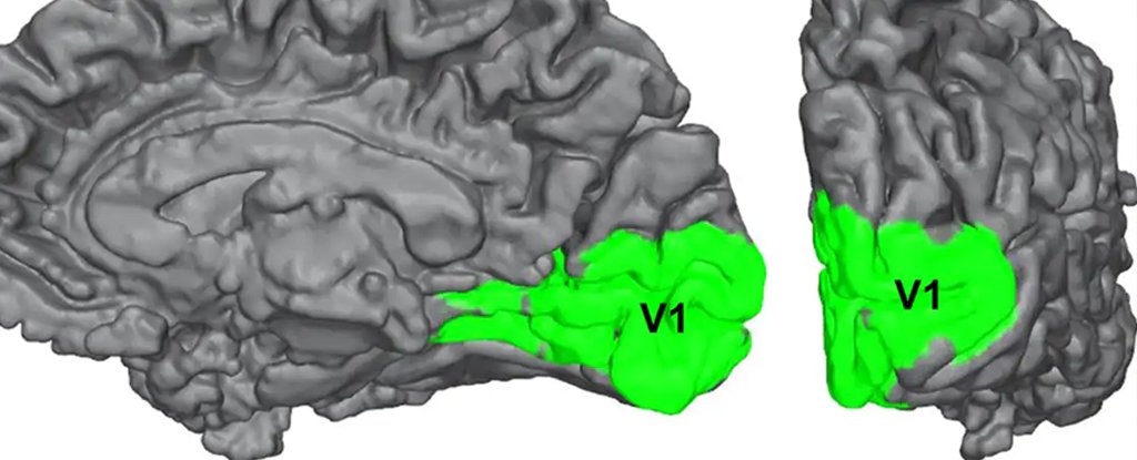 The visual cortex. 