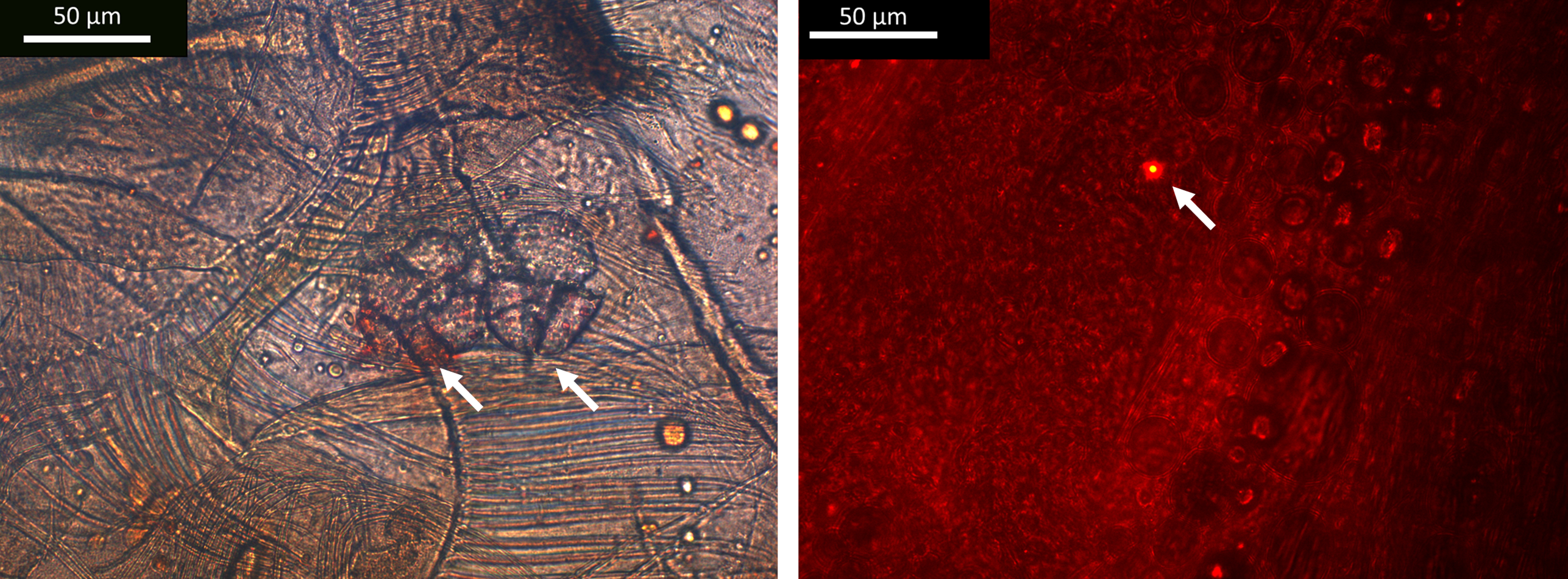 Left: two fragmented microplastics in an amphipod's gut. Right: a nanoplastic fragment. (Alicia Mateos Cardenas)