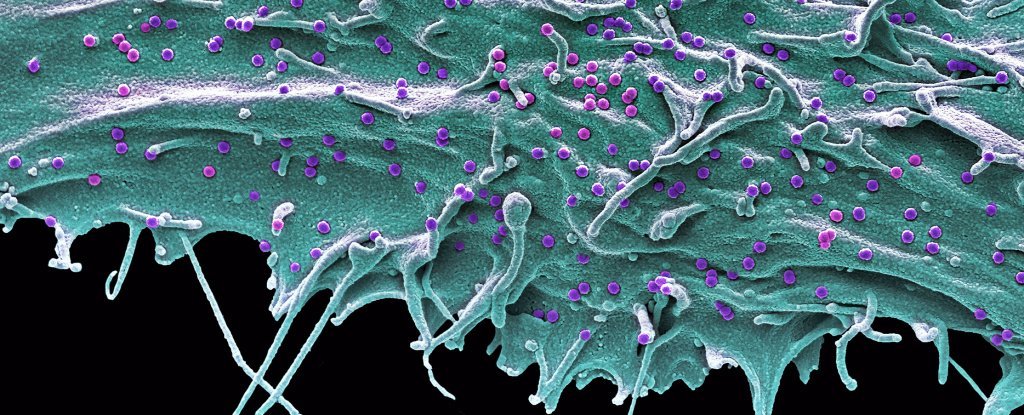 Human cell infected with SIVsm - a cousin of HIV - under a SEM. 