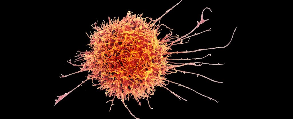 Human killer T cell. 
