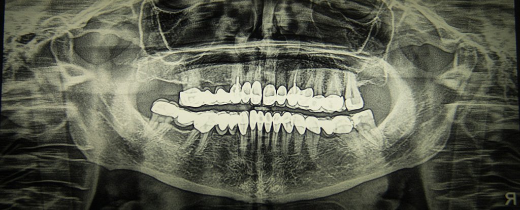 Here's How Exploding Stars Forged The Calcium in Your Teeth And Bones - ScienceAlert