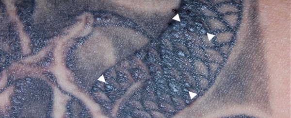 A man lost his hearing and suffered inflamed eyes after getting a standard back tattoo