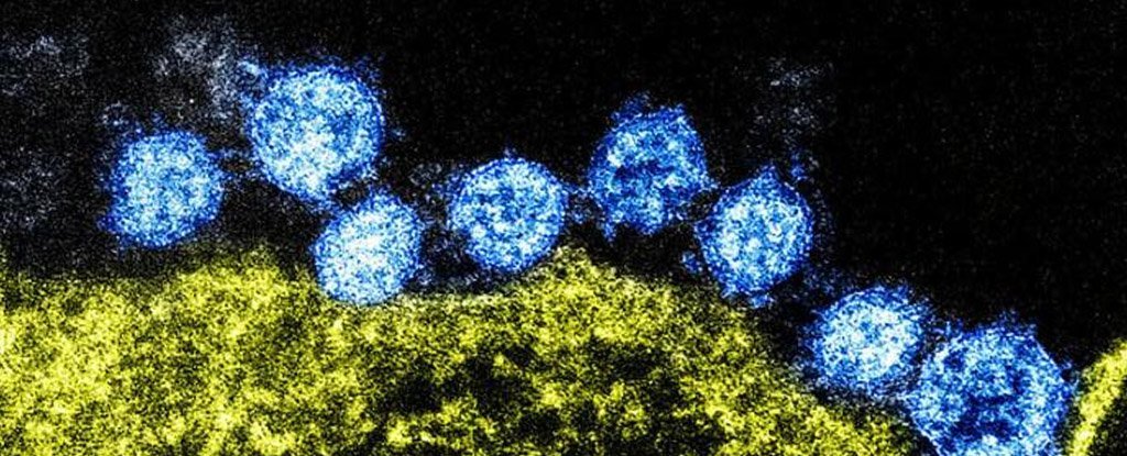 Scanning electron micrograph of MERS coronavirus particles. 