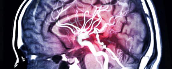There's growing concern COVID-19 could spark a wave of Parkinson's disease