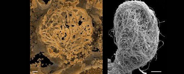 Oldest animal sperm to date was just discovered in 100-million-year-old amber