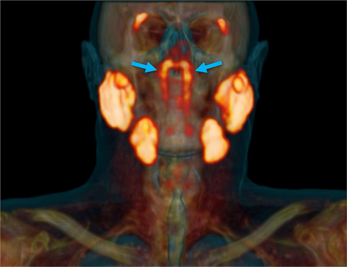 010 salivary glands 1