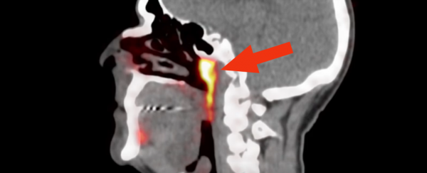 Scientists just discovered a mysterious organ lurking in the centre of the human head