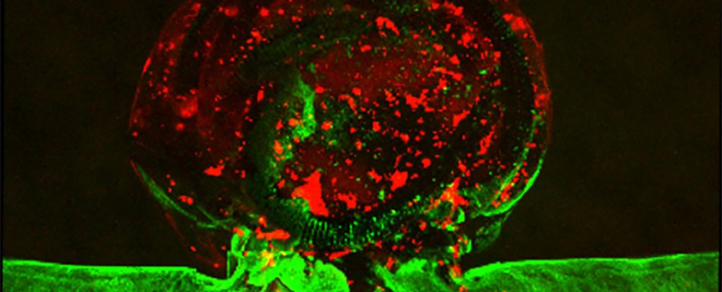 The aneurysm with endothelial cells 