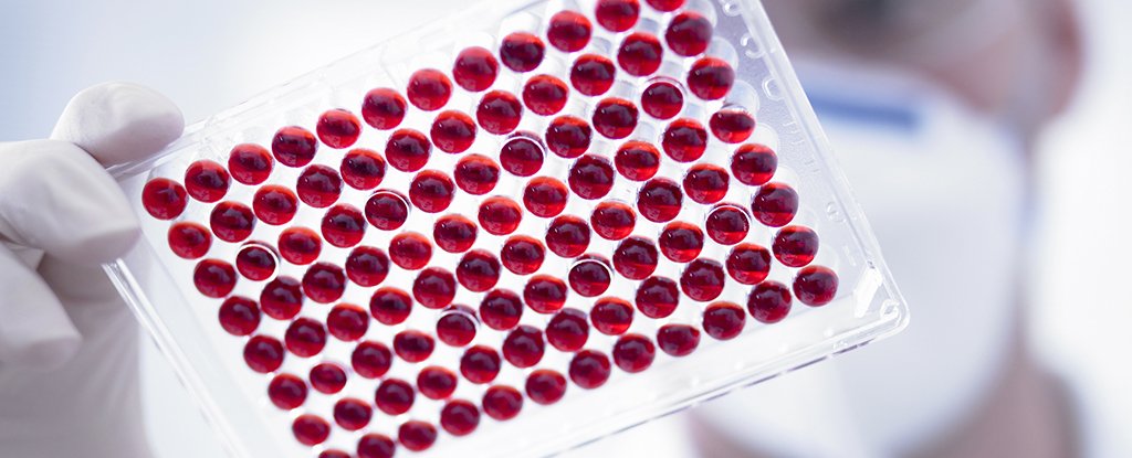We Just Got More Evidence Your Blood Type May Change COVID-19 Risk And Severity - ScienceAlert