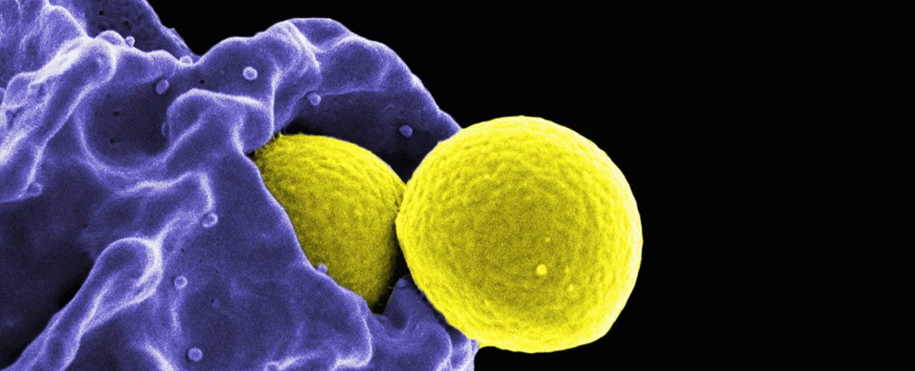 Micrograph of methicillin-resistant Staphylococcus aureus 