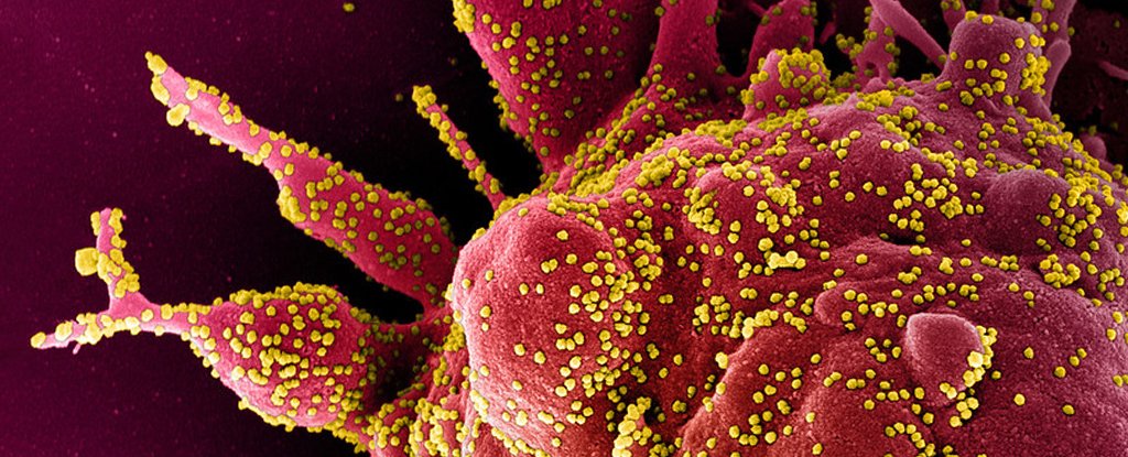 COVID-19 Can Make Patients' Immune Systems Attack Their Own Bodies, Study Shows - ScienceAlert