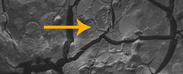 Brain cells turned to glass found in a victim of the Vesuvius eruption