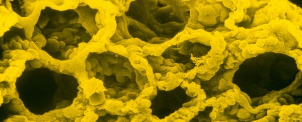 Here's what happens when lab-grown mini-lungs are exposed to SARS-CoV-2