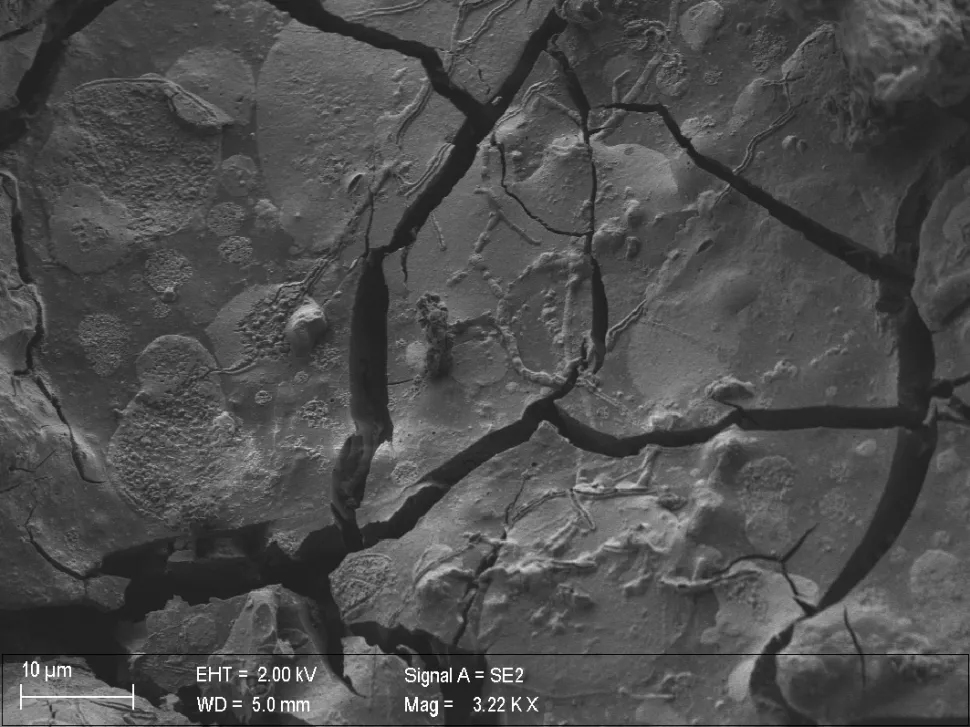 neuron with axons vitrified body 1