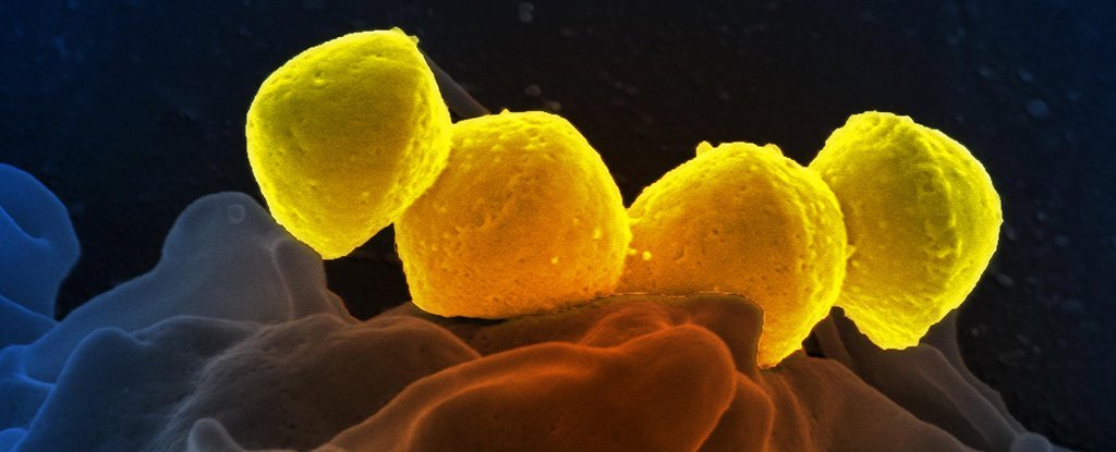Group A Streptococcus on a human neutrophil. 