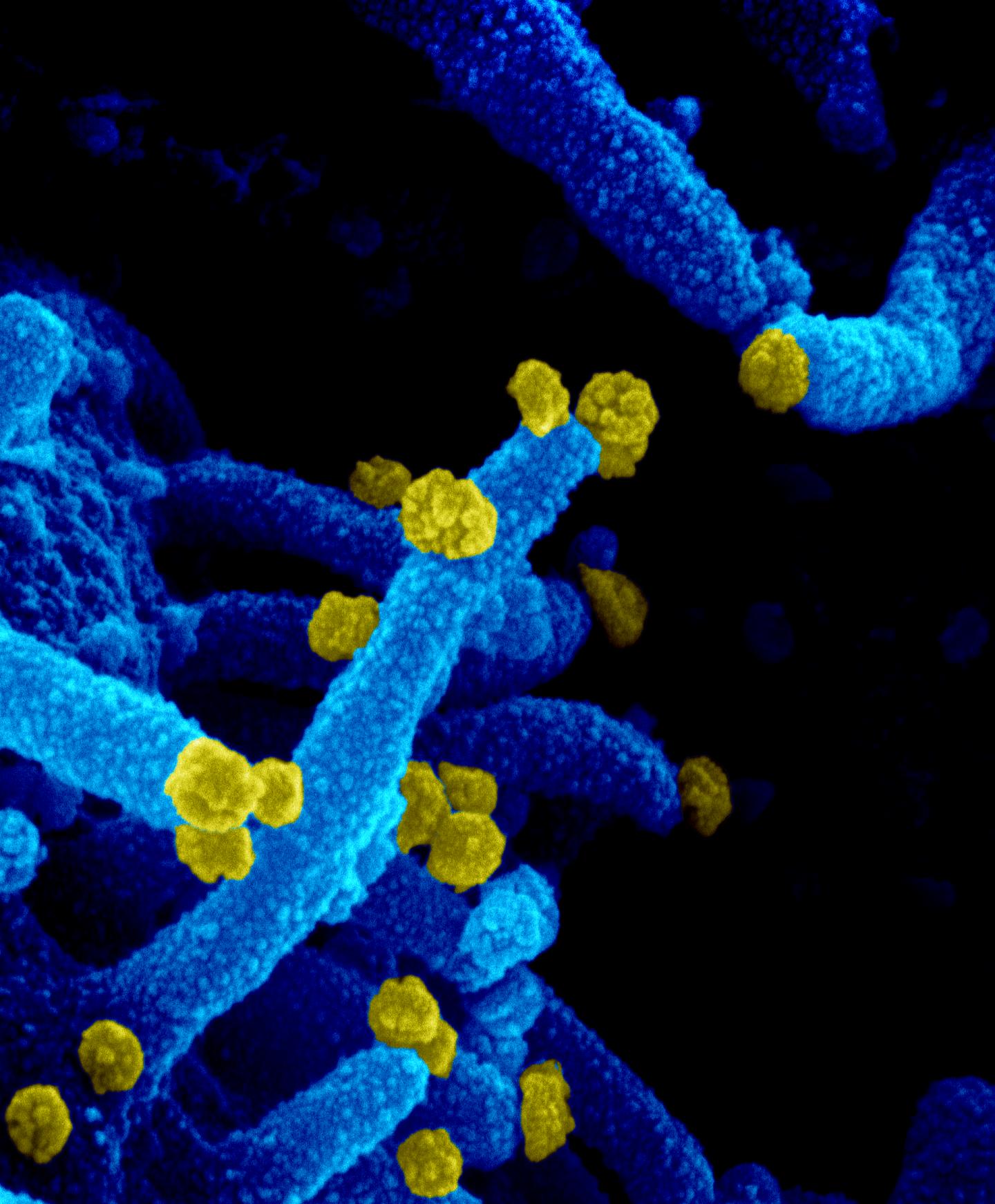 SARS-CoV-2 in lab-grown cells