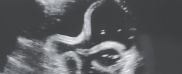 Nightmare ultrasound reveals parasitic worms squirming around inside man's stomach
