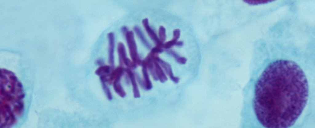 Metaphase in an onion root tip. 
