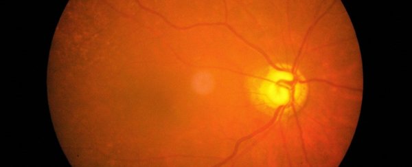 Scientists just successfully regenerated mouse optic nerve cells in the lab
