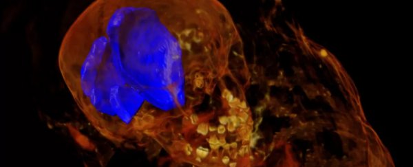 X-Ray scans of Ancient Egyptian mummy reveal a surprising discovery