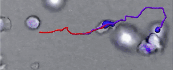 Eerie footage captures human immune cells digging a tunnel through tissue