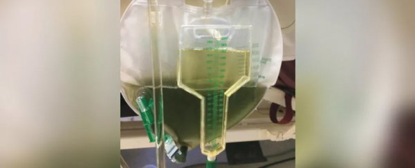 Man's urine turns alarmingly green during hospital stay in rare case study
