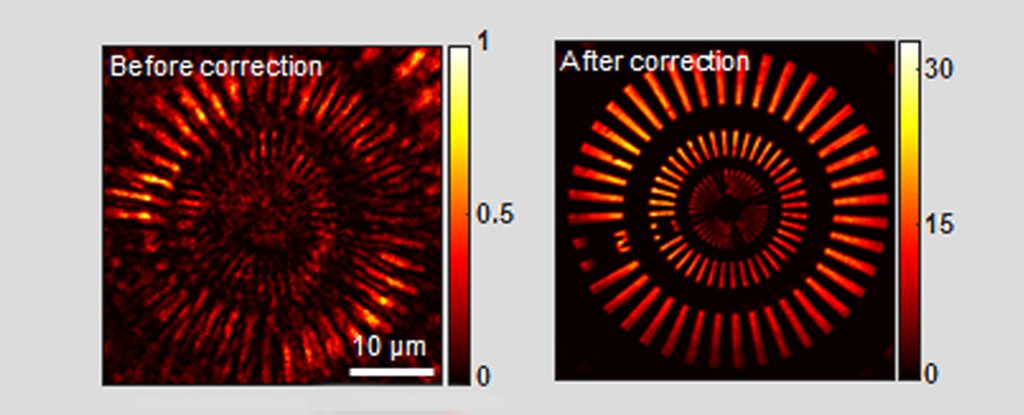 Conventional microscopy 