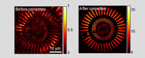 Scientists invent a microscope that can safely look straight through your skull
