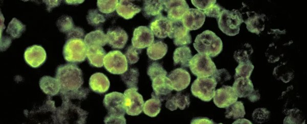 Deadly 'brain-eating' amoeba slowly but surely expanding its footprint in the US
