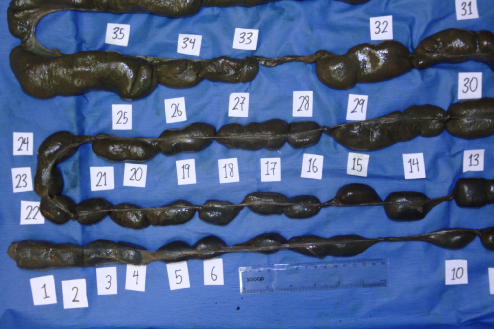 wombat intestine