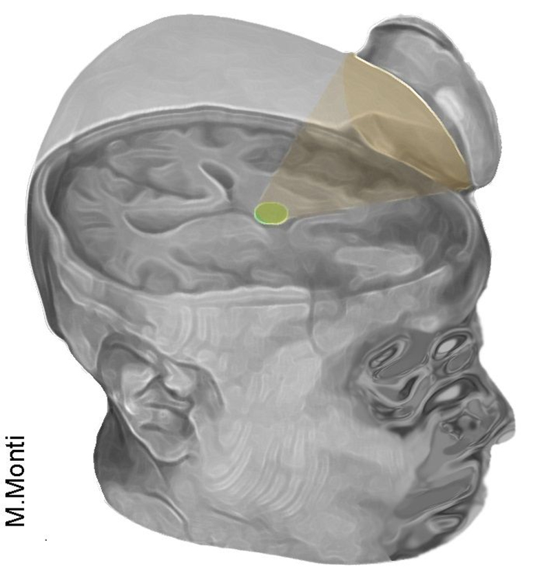 brain scan 2
