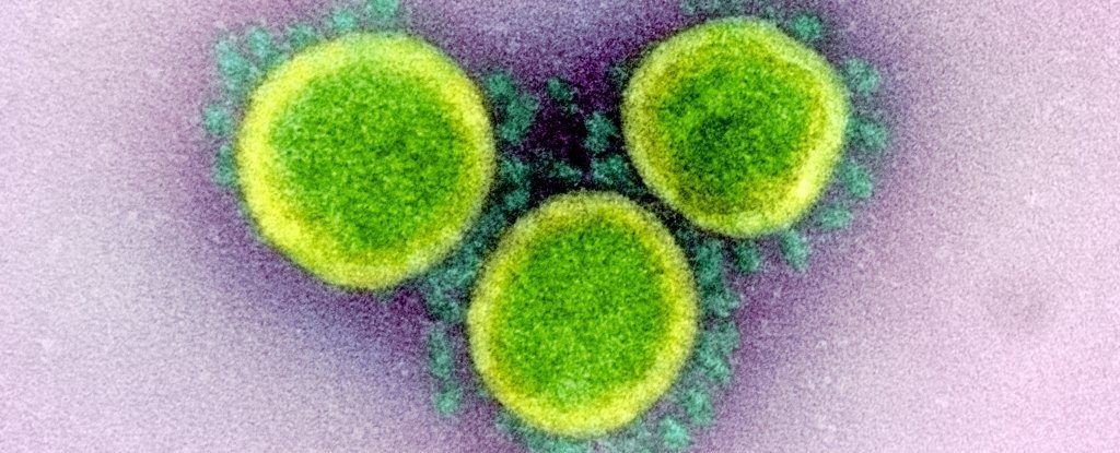 Transmission electron micrograph of SARS-CoV-2 virus particles. 