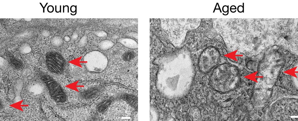 Microscopic images of peritoneal macrophage mitochondria from young and aged mice. 