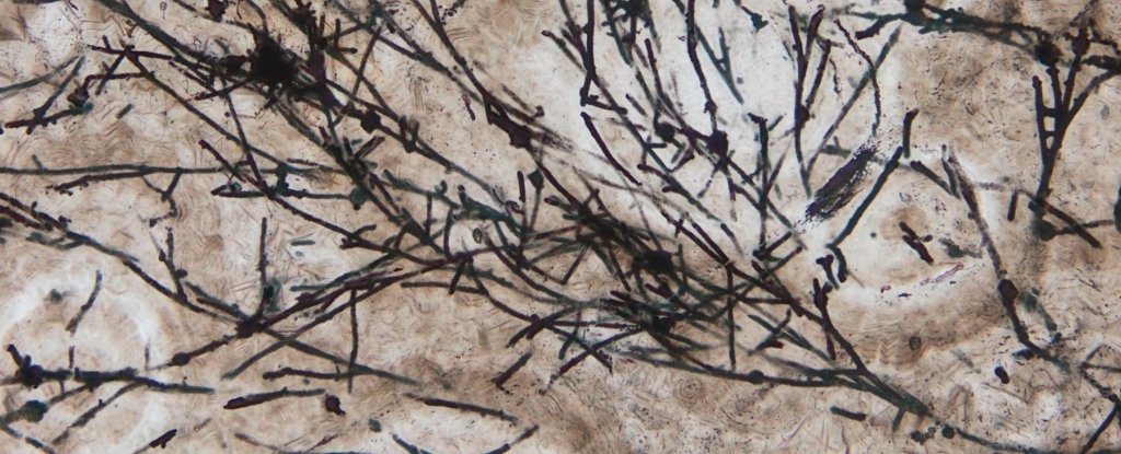 Image of the fungus-like filamentous microfossils.