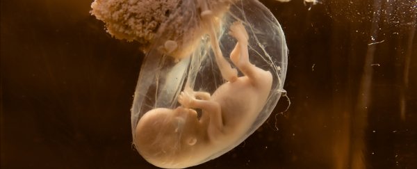 Genes in the placenta appear to determine a baby's risk of developing schizophrenia