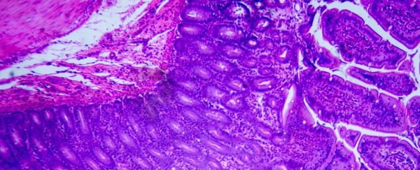 Scientists trick the immune system into healing the gut of mice with inflamed bowels
