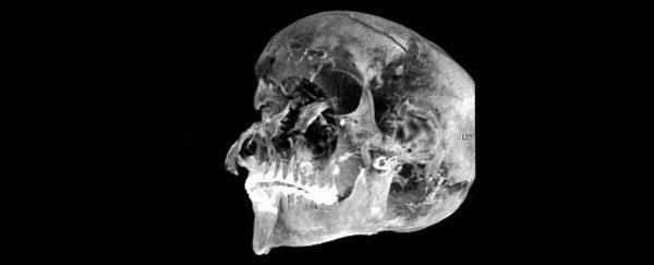 Mummified Remains of Ancient Egyptian Pharaoh Reveal a Reign Ended in Violence