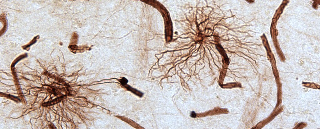Stained astrocytes connecting to blood cells 