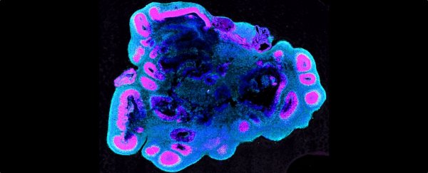 Scientists found a key neurological switch that makes human brains so large