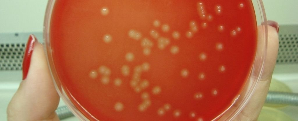 The bacteria behind the ITU make their own DNA blocks in the urine