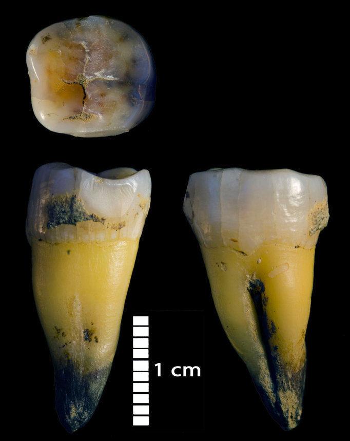 Second lower molar of a modern human found in Bacho Kiro cave. (MPI-EVA/Rosen Spasov)