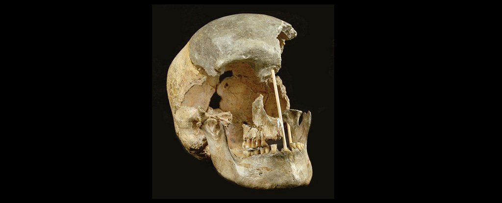 Skull of a modern human from Zlaty kun. 