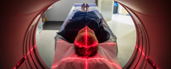 3 distinct subtypes of multiple sclerosis have been identified in brain scans